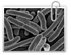 Бактерии способны к самоуничтожению